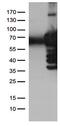 Polo Like Kinase 1 antibody, GTX83865, GeneTex, Western Blot image 