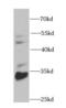 Carbonyl Reductase 3 antibody, FNab01325, FineTest, Western Blot image 