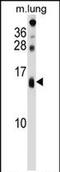 Dexi Homolog antibody, PA5-71978, Invitrogen Antibodies, Western Blot image 