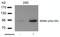 E3 ubiquitin-protein ligase Mdm2 antibody, 79-252, ProSci, Western Blot image 