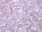 ADP Ribosylation Factor Like GTPase 1 antibody, GTX108258, GeneTex, Immunohistochemistry paraffin image 