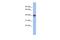 Insulin Induced Gene 1 antibody, A02026, Boster Biological Technology, Western Blot image 