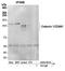 Codanin-1 antibody, A304-951A, Bethyl Labs, Immunoprecipitation image 