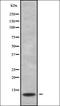 S100 Calcium Binding Protein G antibody, orb338581, Biorbyt, Western Blot image 