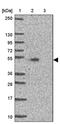 Transmembrane protein 237 antibody, PA5-62647, Invitrogen Antibodies, Western Blot image 