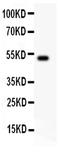 Interleukin-18 antibody, PB9245, Boster Biological Technology, Western Blot image 