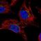 Dynamin 3 antibody, NBP2-56017, Novus Biologicals, Immunocytochemistry image 