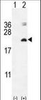 Interleukin 17F antibody, LS-C165178, Lifespan Biosciences, Western Blot image 