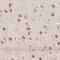 Reticulocalbin 3 antibody, NBP2-38627, Novus Biologicals, Immunohistochemistry paraffin image 