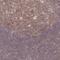 Protein Phosphatase 6 Catalytic Subunit antibody, NBP2-13804, Novus Biologicals, Immunohistochemistry paraffin image 