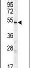 UDP Glycosyltransferase Family 3 Member A2 antibody, PA5-23863, Invitrogen Antibodies, Western Blot image 