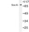 SRY-Box 6 antibody, LS-C176754, Lifespan Biosciences, Western Blot image 