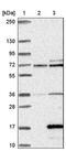 Alpha Hemoglobin Stabilizing Protein antibody, PA5-59361, Invitrogen Antibodies, Western Blot image 