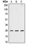 Cathepsin D antibody, LS-C352086, Lifespan Biosciences, Western Blot image 