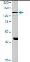 ADAM Metallopeptidase With Thrombospondin Type 1 Motif 17 antibody, orb89809, Biorbyt, Western Blot image 