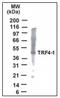 Terminal Nucleotidyltransferase 4A antibody, AP08399PU-N, Origene, Western Blot image 