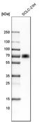 Microtubule associated protein 2ab antibody, HPA008273, Atlas Antibodies, Western Blot image 