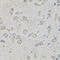 Eukaryotic Translation Initiation Factor 3 Subunit F antibody, 22-639, ProSci, Immunohistochemistry paraffin image 