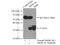 Armadillo Repeat Containing 10 antibody, 20506-1-AP, Proteintech Group, Immunoprecipitation image 