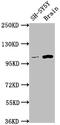 Leucine Rich Repeat Containing G Protein-Coupled Receptor 5 antibody, CSB-RA262034A0HU, Cusabio, Western Blot image 