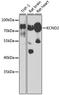 Potassium Voltage-Gated Channel Subfamily D Member 2 antibody, A02358, Boster Biological Technology, Western Blot image 