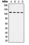 Integrin Subunit Beta 3 antibody, LS-C352406, Lifespan Biosciences, Western Blot image 
