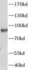 AKAP4 antibody, FNab00256, FineTest, Western Blot image 
