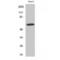 Gamma-Aminobutyric Acid Type A Receptor Alpha4 Subunit antibody, LS-C383614, Lifespan Biosciences, Western Blot image 