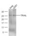 TNF Superfamily Member 10 antibody, GTX01564, GeneTex, Western Blot image 