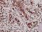 Tryptophan Hydroxylase 1 antibody, A01626-2, Boster Biological Technology, Immunohistochemistry paraffin image 