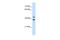 Glycerophosphodiester Phosphodiesterase 1 antibody, PA5-43012, Invitrogen Antibodies, Western Blot image 