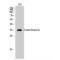 Casein Kinase 1 Alpha 1 antibody, LS-C382442, Lifespan Biosciences, Western Blot image 