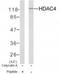 Histone Deacetylase 4 antibody, NBP2-03981, Novus Biologicals, Western Blot image 