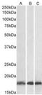 Ubiquitin Conjugating Enzyme E2 L3 antibody, NB300-841, Novus Biologicals, Western Blot image 