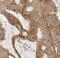 Myeloma Overexpressed antibody, FNab05466, FineTest, Immunohistochemistry frozen image 