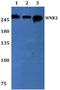 WNK Lysine Deficient Protein Kinase 2 antibody, A07048, Boster Biological Technology, Western Blot image 