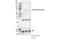 Bruton Tyrosine Kinase antibody, 87457S, Cell Signaling Technology, Western Blot image 