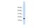 Pleckstrin Homology Like Domain Family A Member 3 antibody, PA5-44236, Invitrogen Antibodies, Western Blot image 