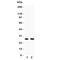 Oligodendrocyte Transcription Factor 1 antibody, R31337, NSJ Bioreagents, Western Blot image 