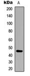 Arrestin Domain Containing 4 antibody, orb235023, Biorbyt, Western Blot image 