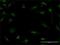 S100 Calcium Binding Protein A7 antibody, H00006278-M01, Novus Biologicals, Immunofluorescence image 