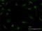 Protein S100-A7 antibody, H00006278-M01, Novus Biologicals, Immunofluorescence image 