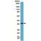 Alpha-Methylacyl-CoA Racemase antibody, M02217-1, Boster Biological Technology, Western Blot image 