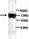 Protein Kinase C Eta antibody, TA310126, Origene, Western Blot image 