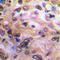 Nuclear Factor Kappa B Subunit 1 antibody, LS-C358828, Lifespan Biosciences, Immunohistochemistry paraffin image 