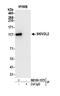 Mtr4 Exosome RNA Helicase antibody, NB100-1575, Novus Biologicals, Western Blot image 