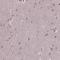 Plakophilin 3 antibody, HPA062937, Atlas Antibodies, Immunohistochemistry paraffin image 