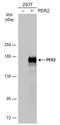 Period Circadian Regulator 2 antibody, GTX134478, GeneTex, Western Blot image 