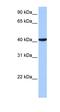Coiled-Coil And C2 Domain Containing 1B antibody, orb325744, Biorbyt, Western Blot image 