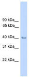 Aminolevulinate Dehydratase antibody, TA346242, Origene, Western Blot image 